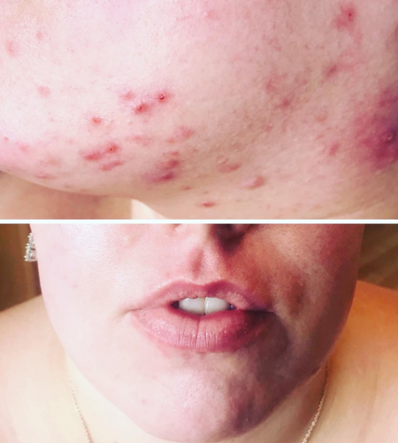 Prescription-strength skincare products for targeted treatment of acne, pigmentation and signs of ageing.
